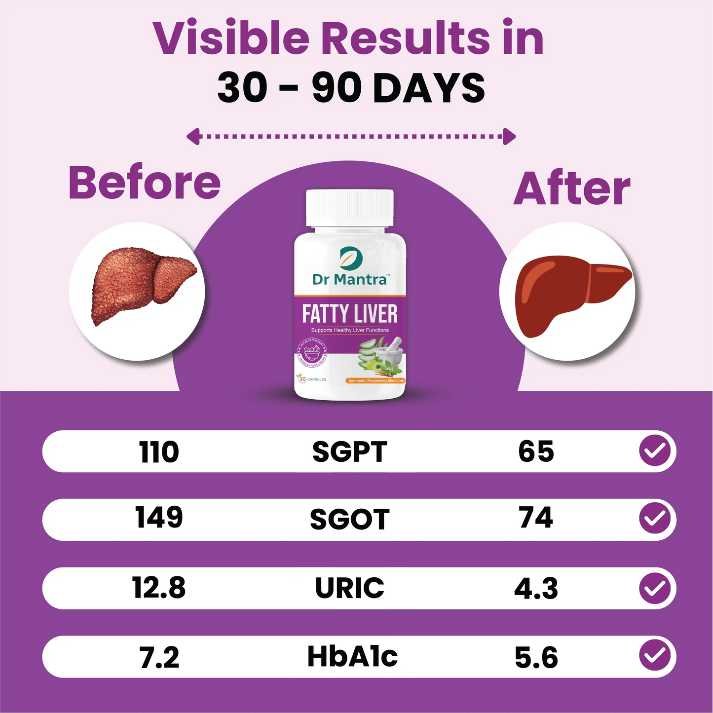 Dr Mantra Ayurvedic Fatty Liver Capsules for Healthy Liver| 30 Capsules