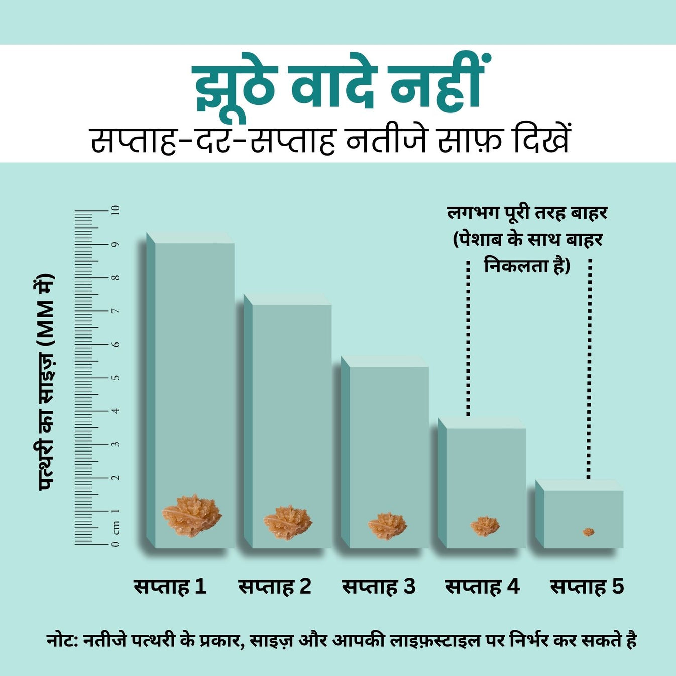 Kidney Stone Crusher (Free Diet Chart & Ayurveda Expert Consultation )