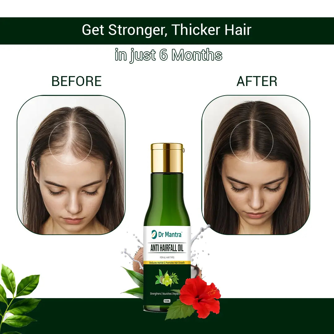 Dr Mantra Anti Hair For Oil | 100 ml