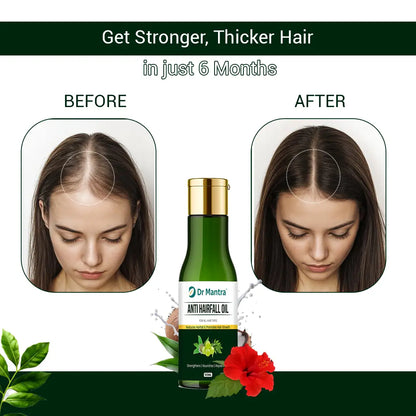 Dr Mantra Anti Hair For Oil | 100 ml