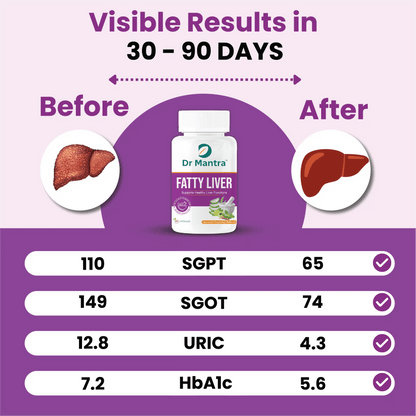 Dr Mantra Ayurvedic Fatty Liver Capsules for Healthy Liver| 30 Capsules