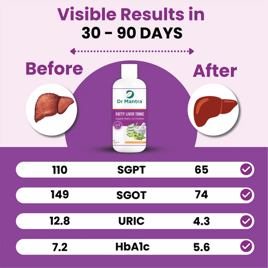 Dr Mantra Fatty Liver Tonic