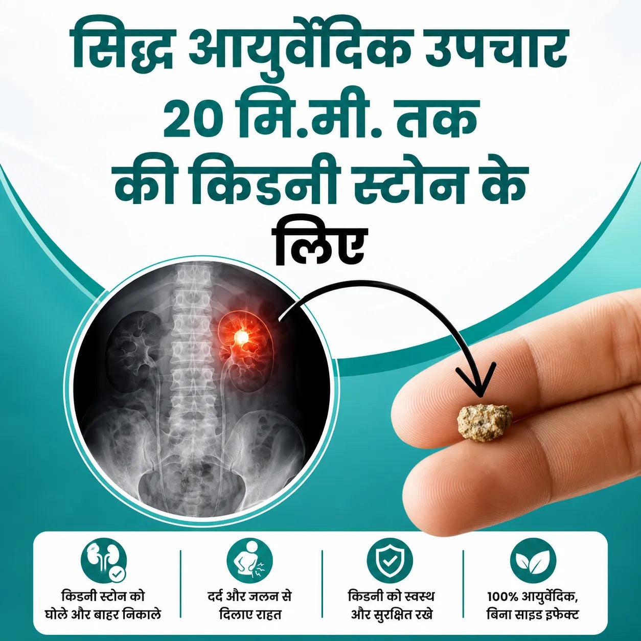 Kidney Stone Crusher (Free Diet Chart & Ayurveda Expert Consultation )