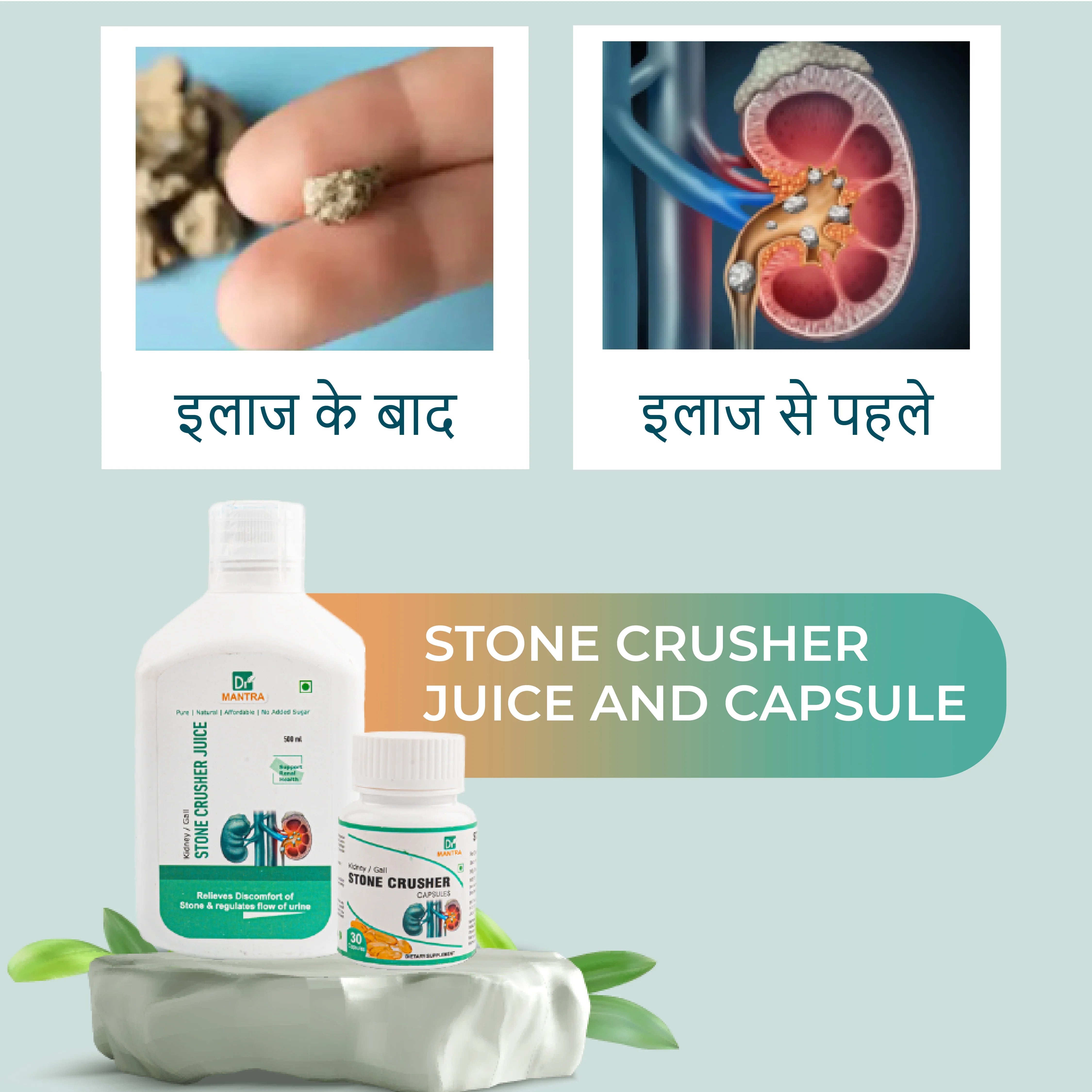 Kidney Stone Crusher Juice (Free Diet Chart & Ayurveda Expert Consultation )