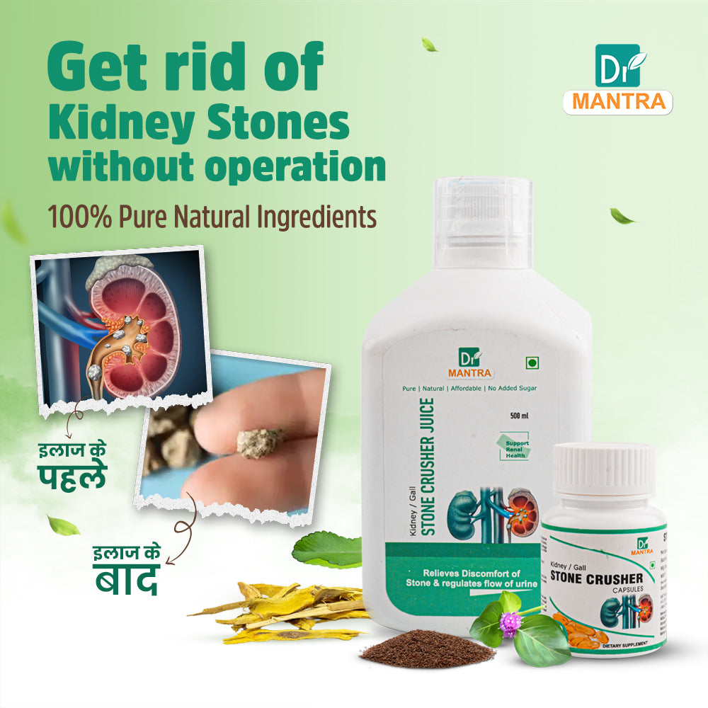 Kidney Stone Crusher Juice (Free Diet Chart & Ayurveda Expert Consultation)